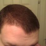 Today- see, not much difference